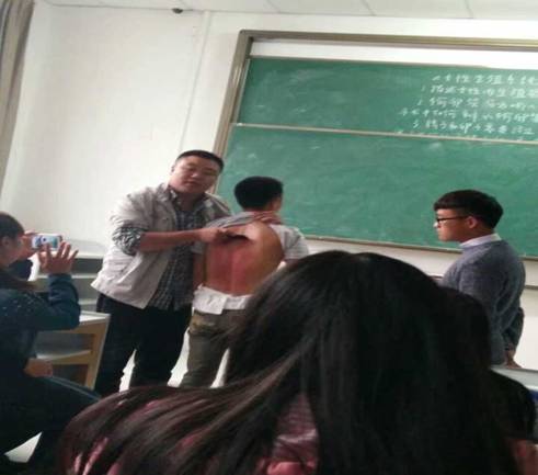 刮痧